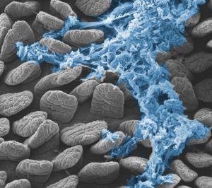 Zoom: Die Darmzotten einer Maus (Foto) sind identisch aufgebaut wie bei Menschen. Die Schleimschicht (Mucosa, blau) schützt die Darmwand vor schädlichen Bakterien Bild: Sonnenburg lab/Stanford University