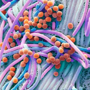 Vielfalt: Rund 1.000 Bakterienarten besiedeln den menschlichen Darm – mehr als 50 Prozent des Stuhls bestehen aus diesen Bakterien, etwa E. Coli. Bild: Steve Gschmeissner/Science Photo Library